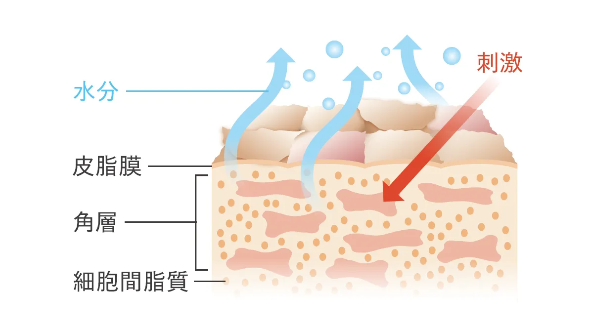 敏感肌の肌の断面図です。バリア機能が低下して水分が失われ乾燥状態となった肌に刺激となる物質が侵入していく様子を示しています。