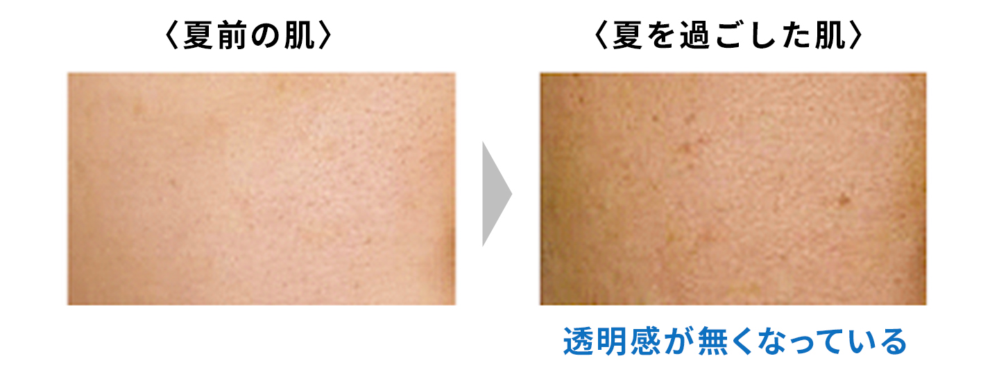 夏を過ごした肌と、夏前の肌の比較写真