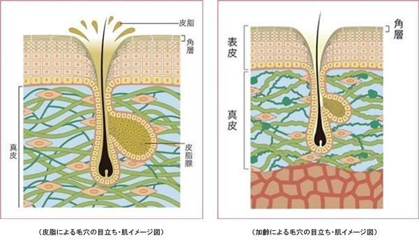 毛穴が目立ってしまう2大原因と肌の状態とは?