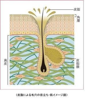 角栓ができるメカニズム