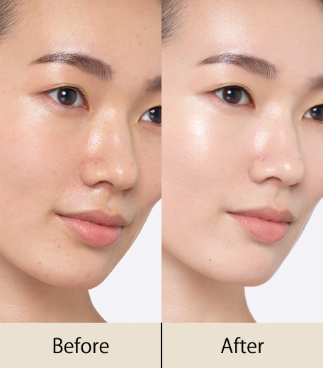 Before / After
