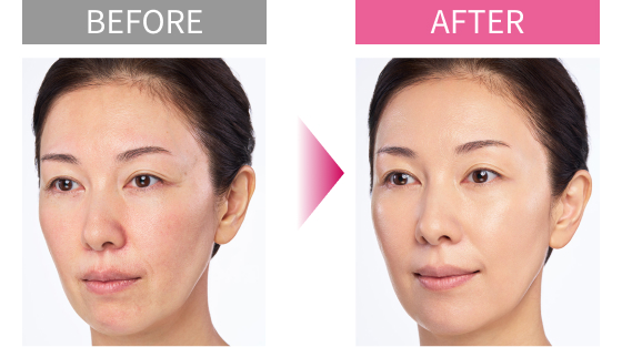 BEFORE AFTER